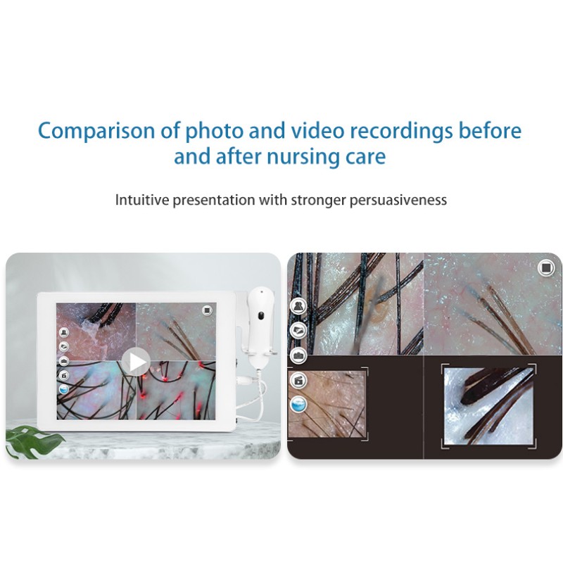 High Definition Skin Scalp Analyzer Facial Care Device Skin Scanner Hair Growth Follicle Detection Device