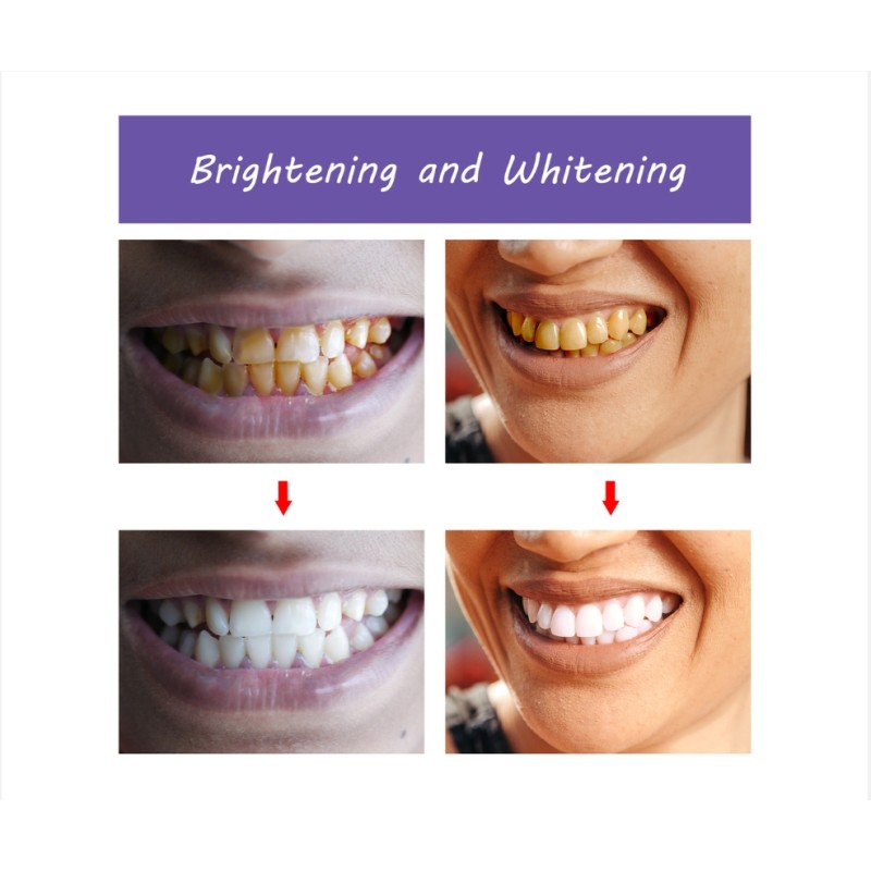 Hot  Sales of Purple Teeth Mousse Teeth Whitening  Fresh Breath Toothpaste to Remove Teeth Yellow Wholesale Price