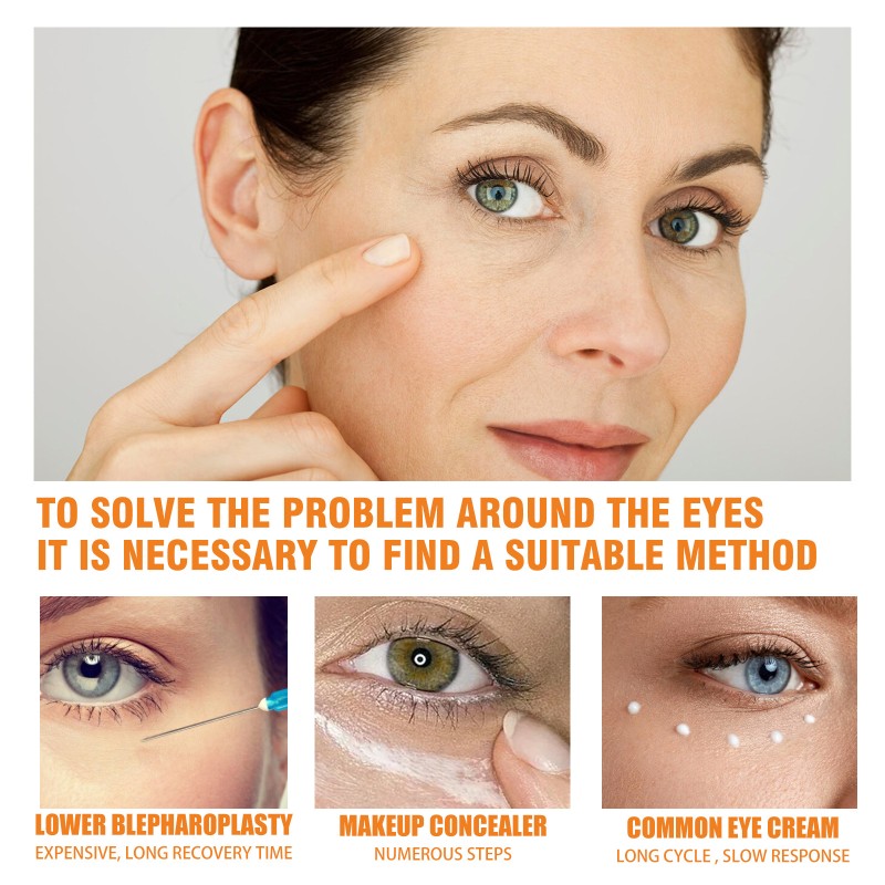 Hot Hot Turmeric Vitamin C Repair Eye Cream Fade Eye Bags Dark Circles Moisturizing Eye Cream Wholesale Price 30g