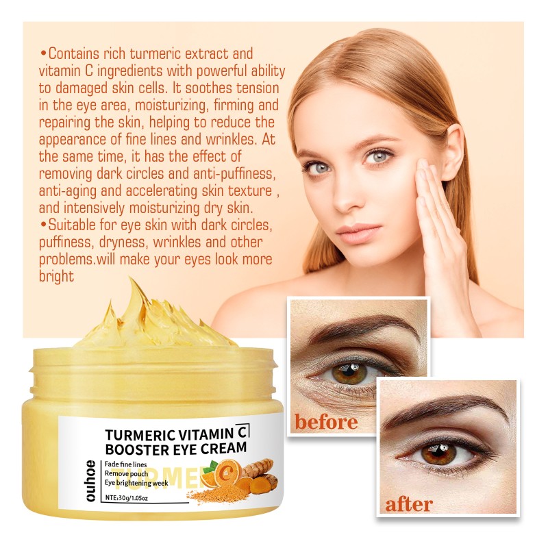 Hot Hot Turmeric Vitamin C Repair Eye Cream Fade Eye Bags Dark Circles Moisturizing Eye Cream Wholesale Price 30g