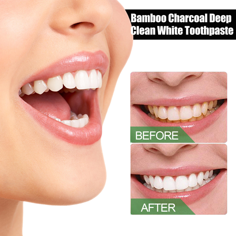 Best-selling Bamboo Charcoal Powerful Whitening Toothpaste for Deep Teeth Cleaning and Whitening, Removing Oral Odor 100g