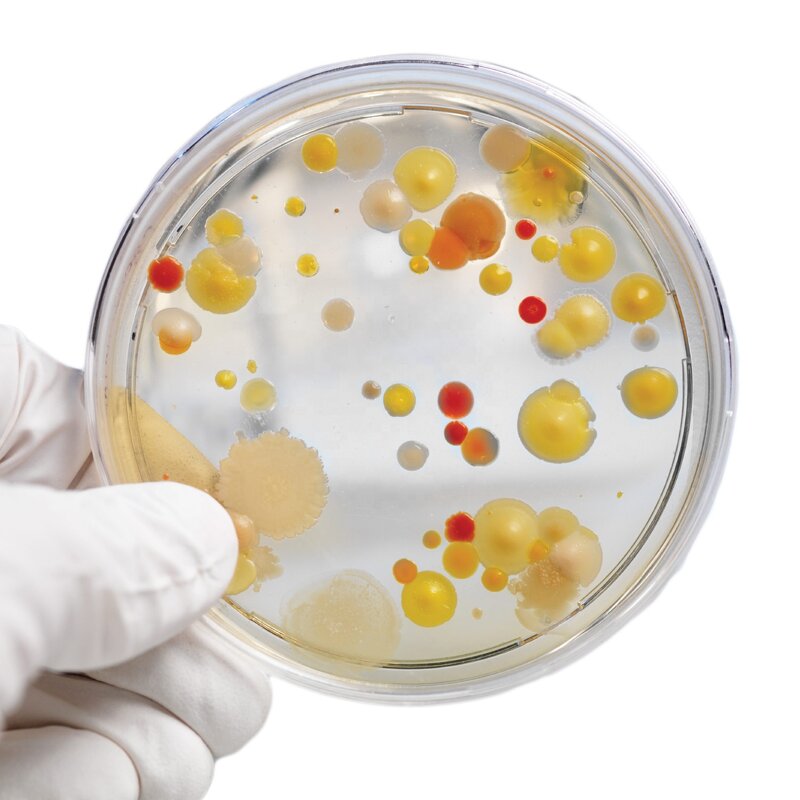 Plastic Petri Dish Factory - OEM Custom High Quality Sterile for Machine