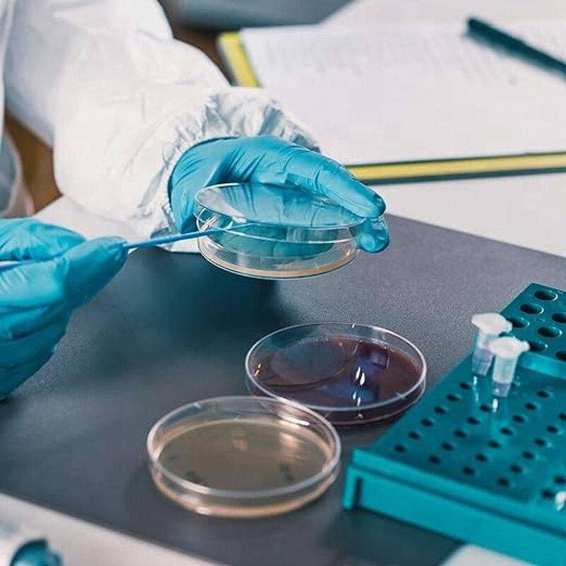 Plastic Petri Dish Factory - OEM Custom High Quality Sterile for Machine