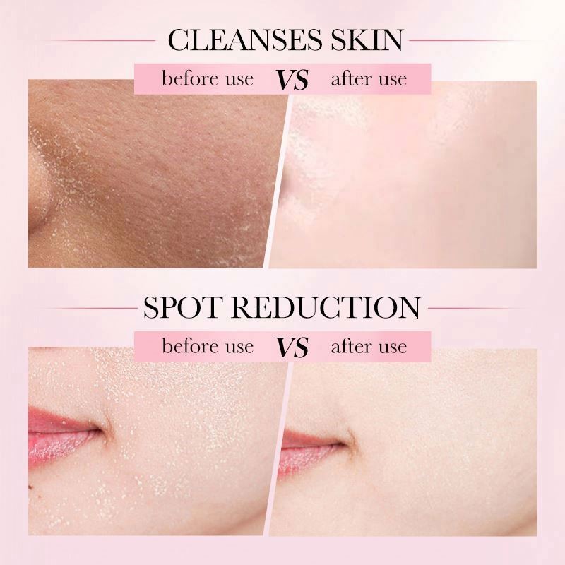 Care Set OEM Factory 4 in 1roll on Eye Cream Hydrocotyle Lightening Face Anti Aging Natural Ingredients Beauty Skin