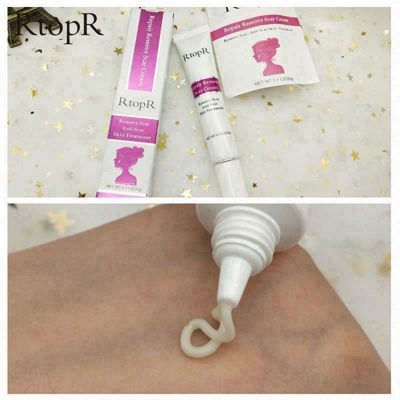 Cheaper Best Quality Removal Natural Oil OEM Acne Scar Bb Foundation Cream