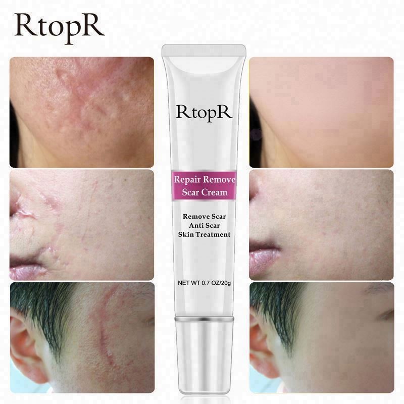 Cheaper Best Quality Removal Natural Oil OEM Acne Scar Bb Foundation Cream