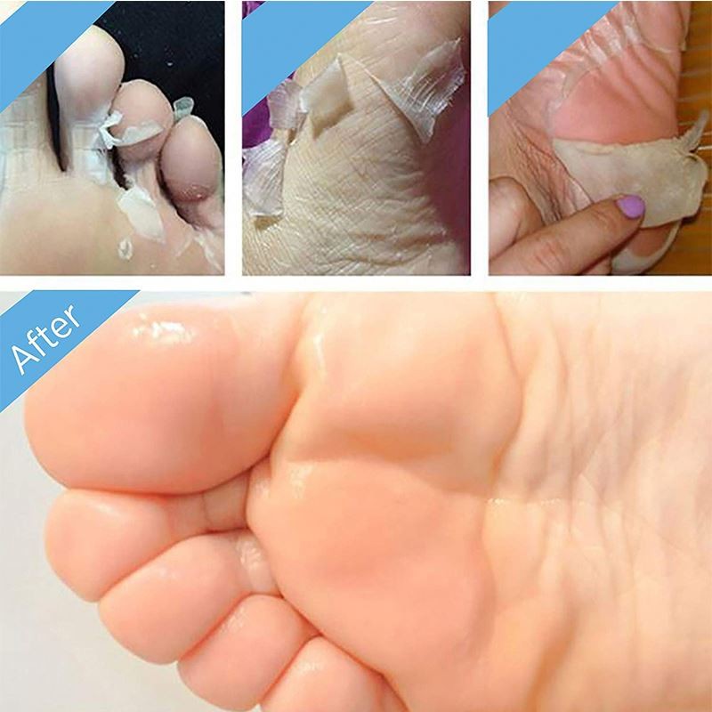 Foot Peeling Mask