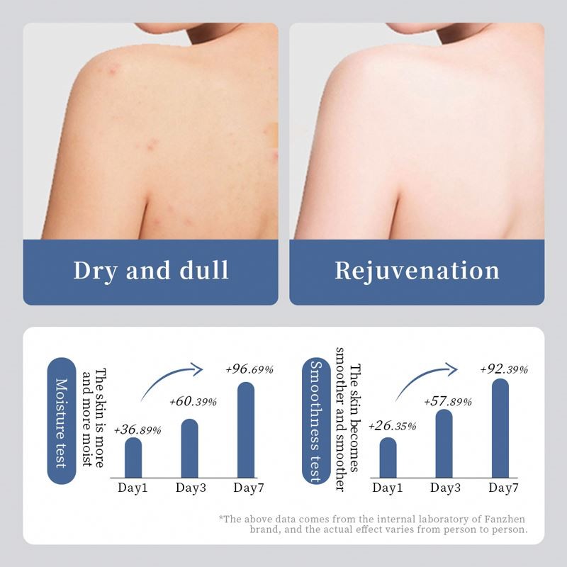 OEM ODM VEZE Wholesale Deep Moisturizing Squalane Skin Care Body Cream Rejuvenation Body Lotion