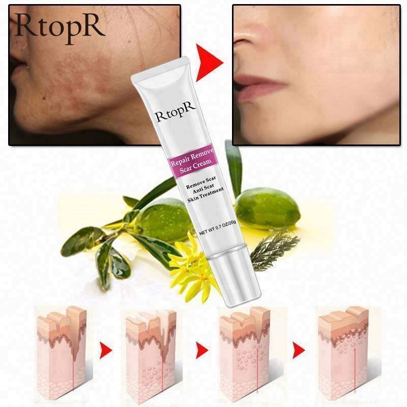 Cheaper Best Quality Removal Natural Oil OEM Acne Scar Bb Foundation Cream