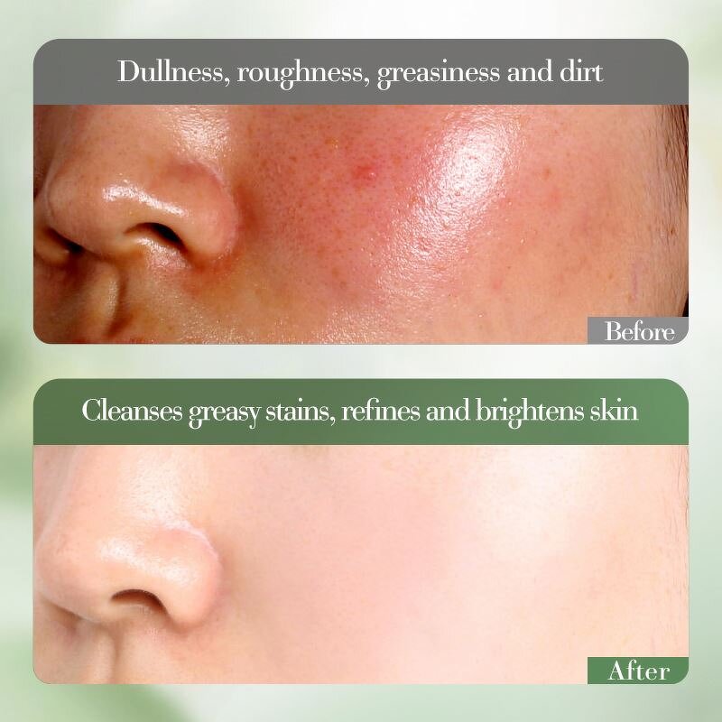 OEM Wholesale FAYANKOU Vegan Amino Acid Refreshing Oil Control Gentle Hyaluronic Acid Organic Kiwi VC Whitening Facial Cleanser