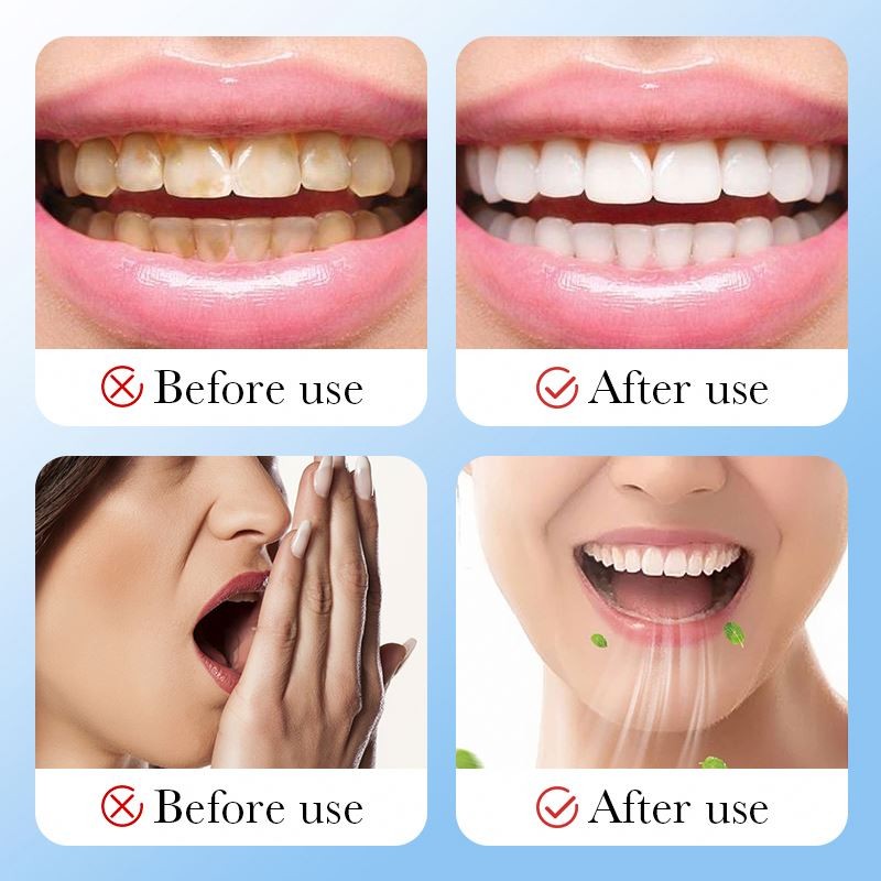OEM VENZEN Private Label Teeth Whitening Keep Oral Clean Oral Care Deep Cleansing Tooth Powder