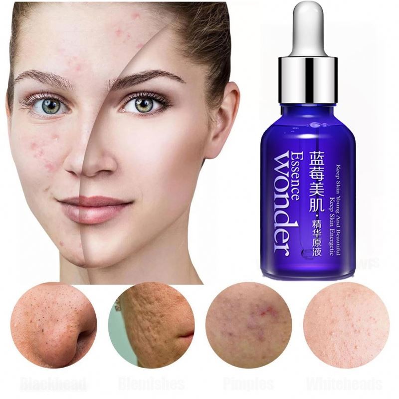 OEM BIOAQUA Private Label Wholesale Essence Oil Serum Anti Aging Acne Mark Cleansing Organic Herbal Whitening Face Serum