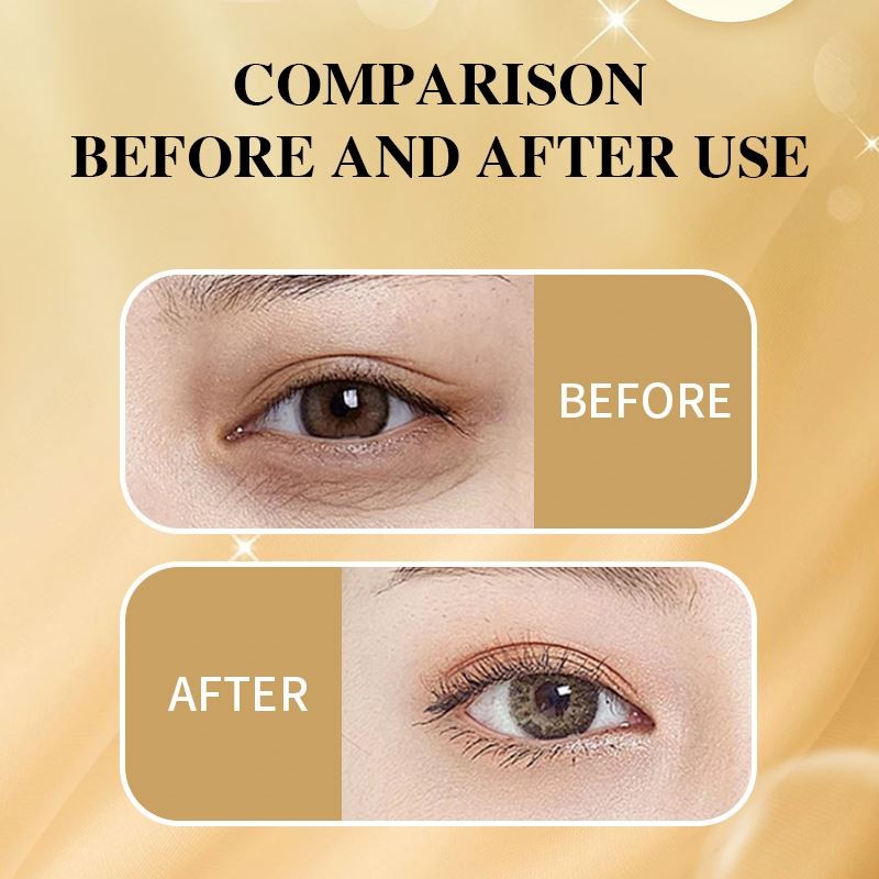 Hot Selling Customized Gold Mask Anti Wrinkles Remove Dark Circles Reduce Fine Lines Moisturize Hydrogel Under Eye Patches