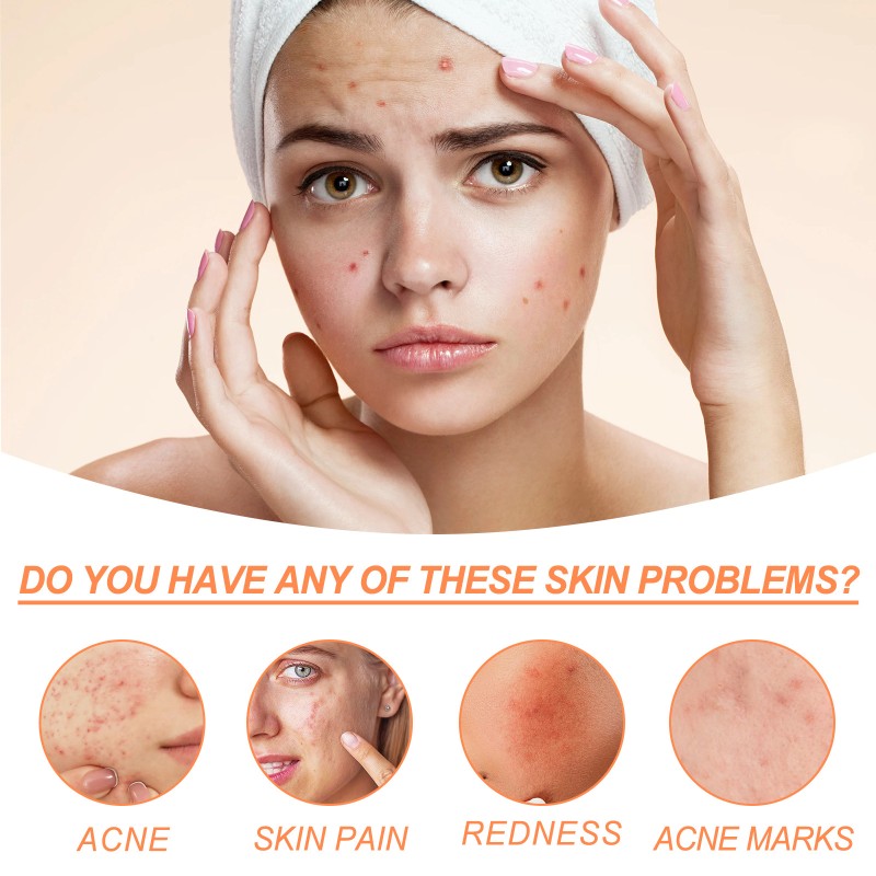 Lanthome Wholesale Face Cream Anti Acne Moisturizing Whitening Nourish Turmeric Cream