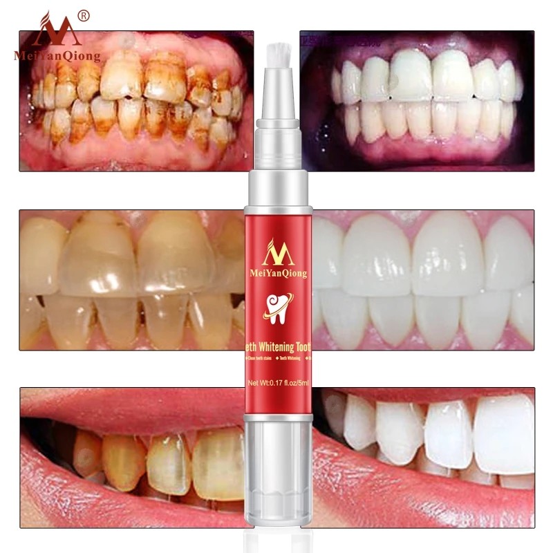 Professional Teeth Whitening Gel Bleaching Cleaning Teeth Whitening Brush