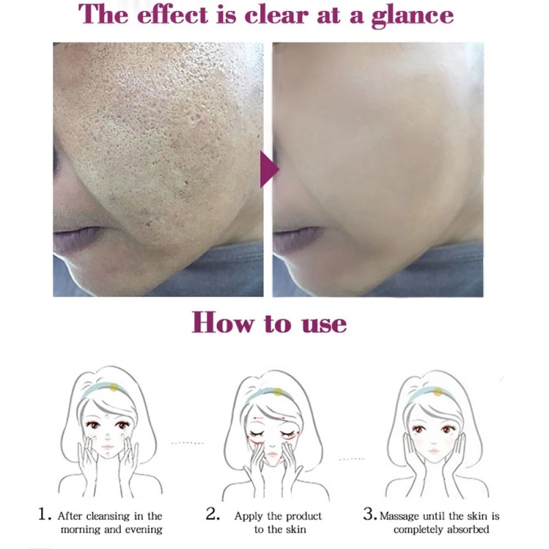 Hot Sale Organic Herbal Face Cream for Acne & Scar Removal Top-Rated Collagen Gel for Effective Skin Care