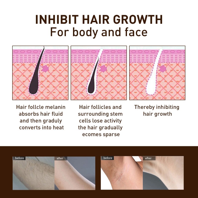 Wholesale Snake Oil Hair Growth Inhibition Spray Non-irritating Stop Hair Spray