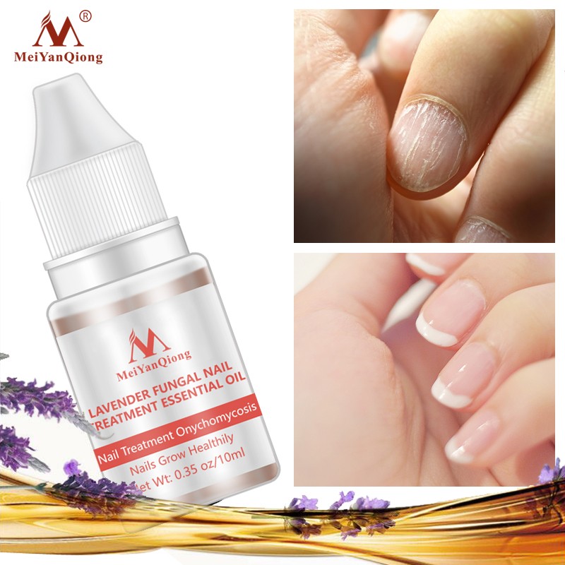 New Arrival Plant Extract Lavender Nail Growth Oil Lavender Fungal Nail Treatment Essential Oil Set Nail Protector Products