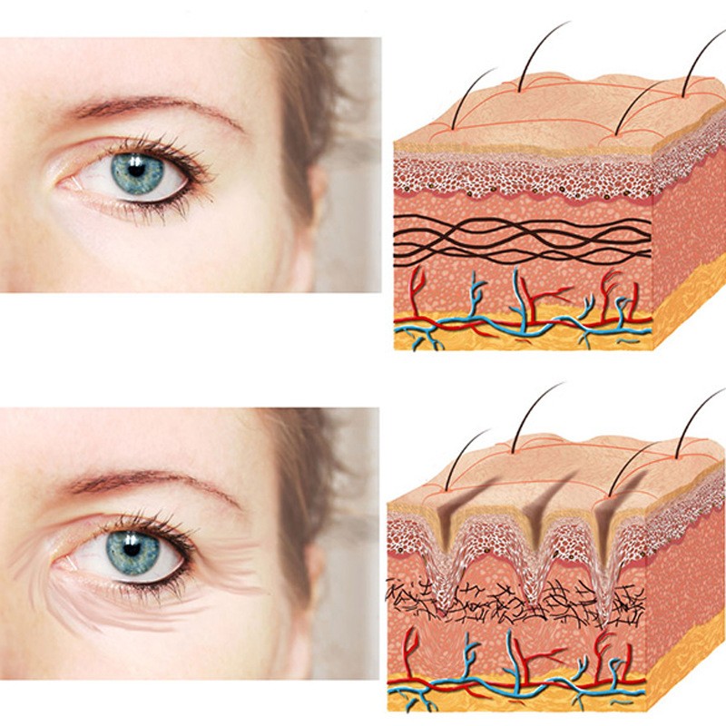 OEM Crystal Eye Mask Moisturizing Anti-Wrinkle Cooling Eye Bags Care Patch with Vitamin Aloe Vera Ingredients Sheet Form Gels