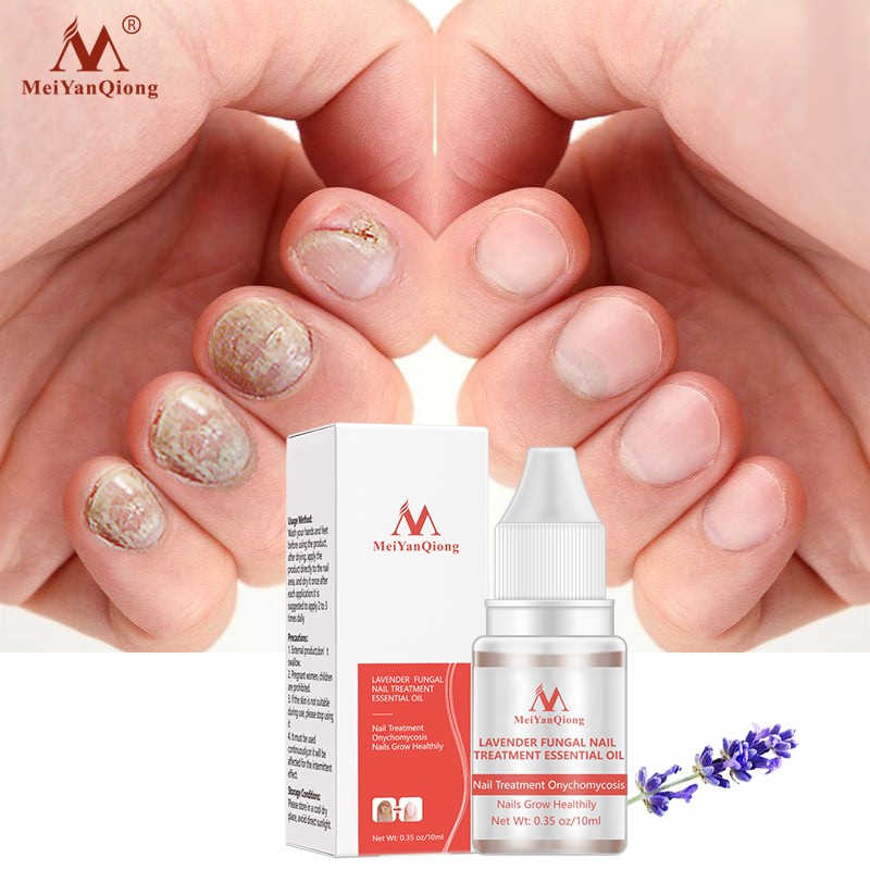 New Arrival Plant Extract Lavender Nail Growth Oil Lavender Fungal Nail Treatment Essential Oil Set Nail Protector Products