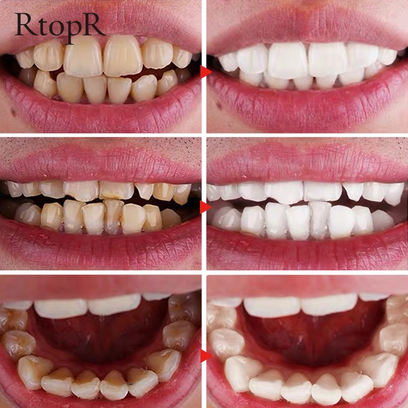 Oral Hygiene Care Teeth Whitening Mousse Remove Plaque Dental Organic Tooth Whitening