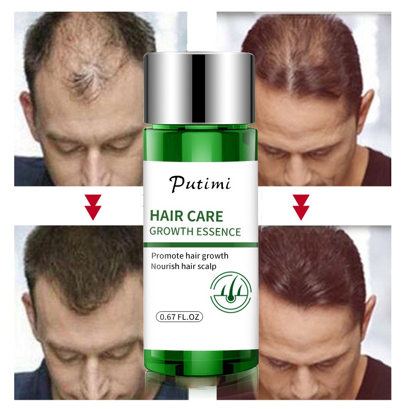 Organic Hair Growth SerumTreatment Preventing Hair Loss Moisturizing Wild Growth Hair Oil