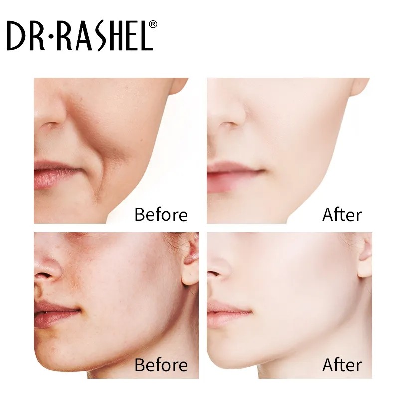 Dr Rashel Skin Revitalizer Whitening Cream and Wrinkles Face Cream Set