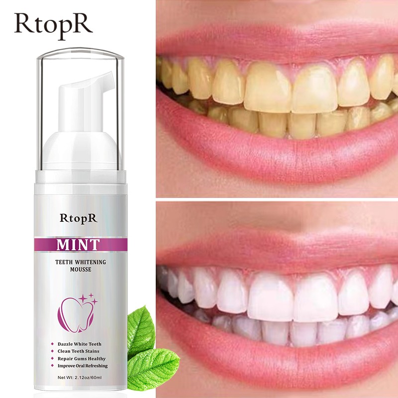 Oral Hygiene Care Teeth Whitening Mousse Remove Plaque Dental Organic Tooth Whitening