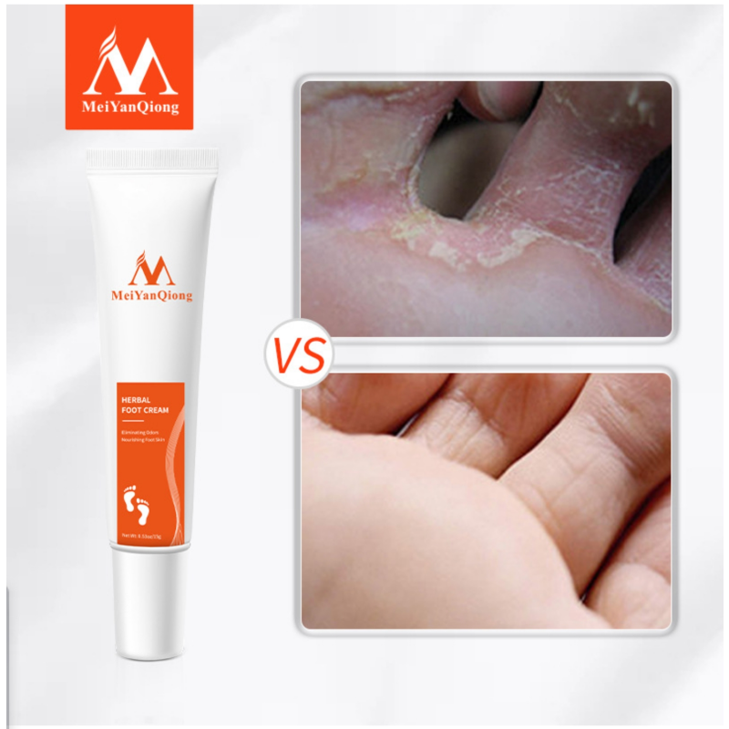 Herbal Effective Foot Anti Fungal  Foot Care Products Cream Adults Female Skin Repair 3 Years OEM ODM Accept
