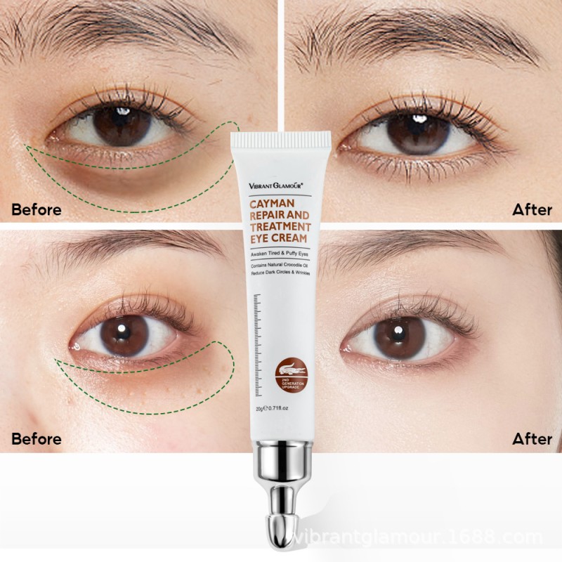 Best Organic Herbal Anti-Aging Eye Cream for Dry Skin Private Label OEM Instant Eye Bag Removal & Wrinkle Repair Cream