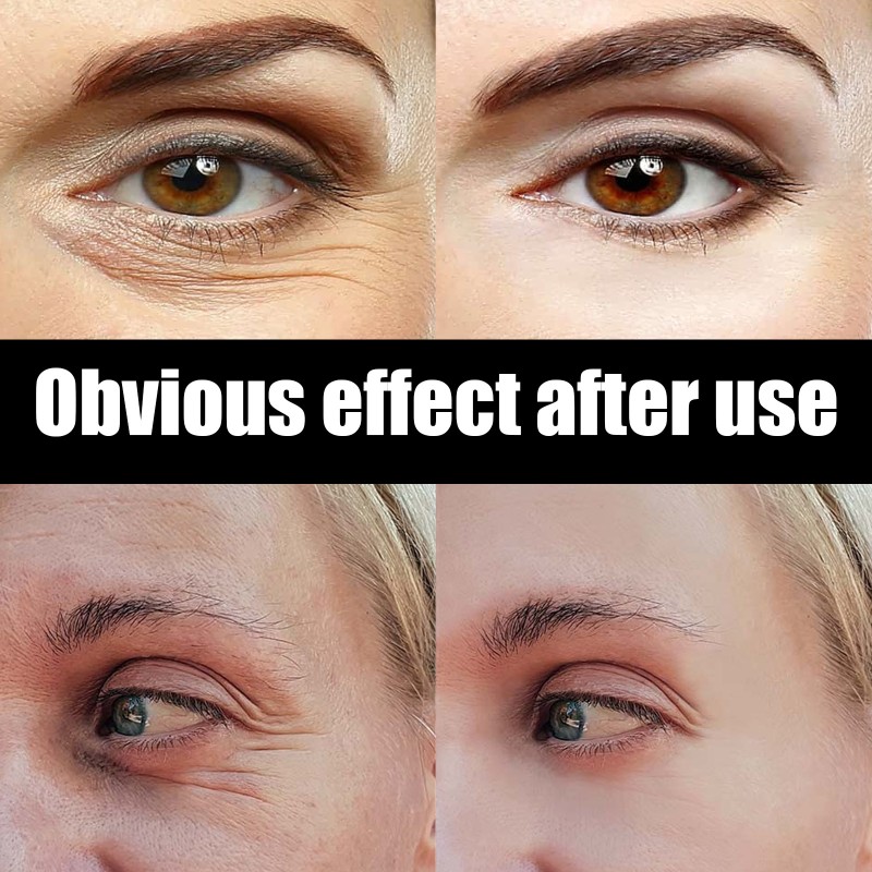 Private Label Oem Anti Aging Repair Best Dark Circles Instant Eye Bag Removal Cream