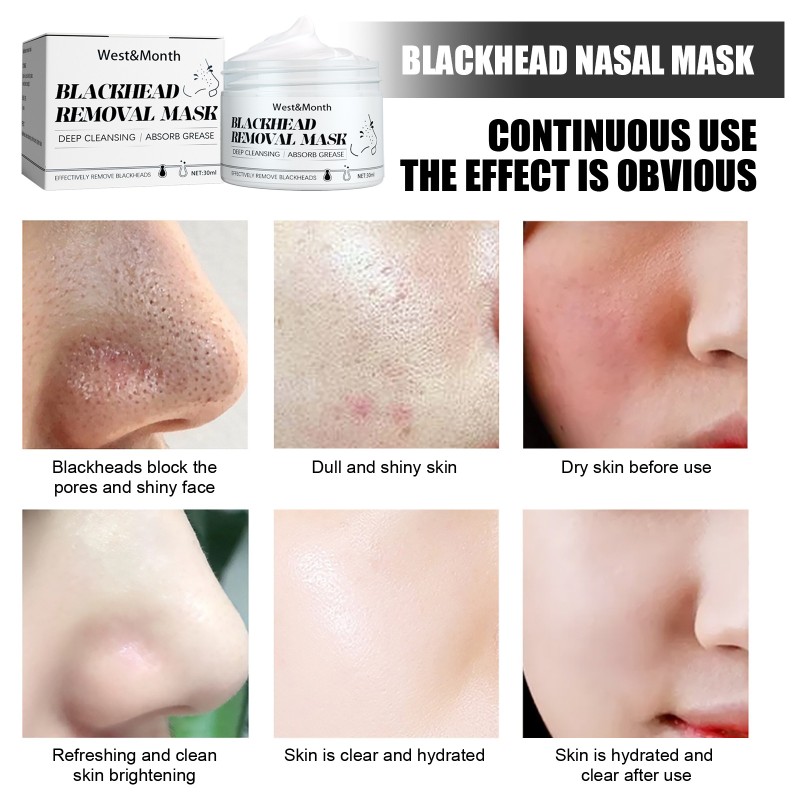 Hot Selling Mineral Nose Mask Deep Cleansing Blackhead Removal Strips for Nose Skin Pores Shrinking Patch Nose Mask