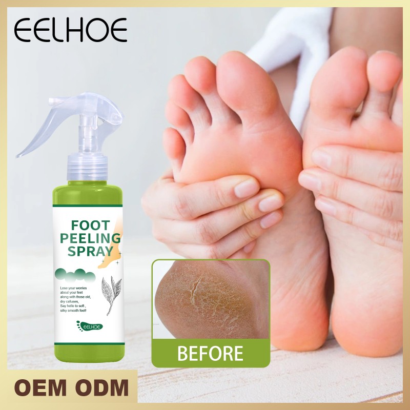 New Arrival Organic Tea Extract Foot Peeling Spray Natural Whole Foot Exfoliate Moisturizing Protector Nail Supplies