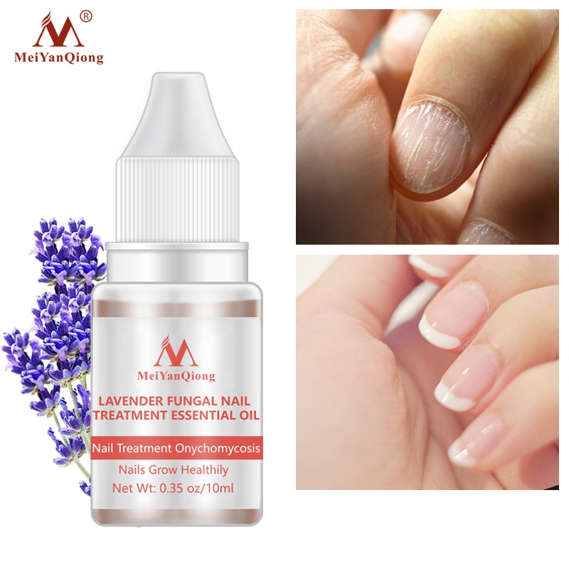 New Arrival Plant Extract Lavender Nail Growth Oil Lavender Fungal Nail Treatment Essential Oil Set Nail Protector Products