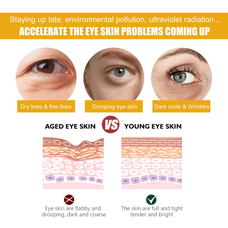 EELHOE Eye Care Moisturizing Fade Dark Circles Brightening Repairing Vitamin C Turmeric Eye Cream