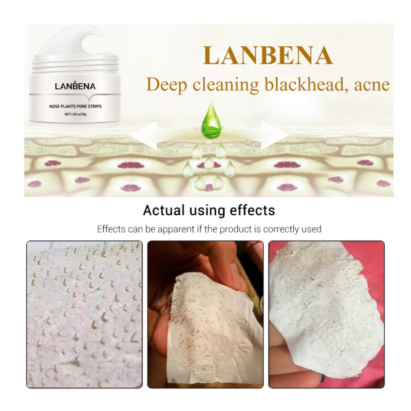Organic Nose Blackhead Mask Deep Clean Blackhead Remover Cream Cotton Female Nose Strips 5- 7 Working Days 3 Years 65g