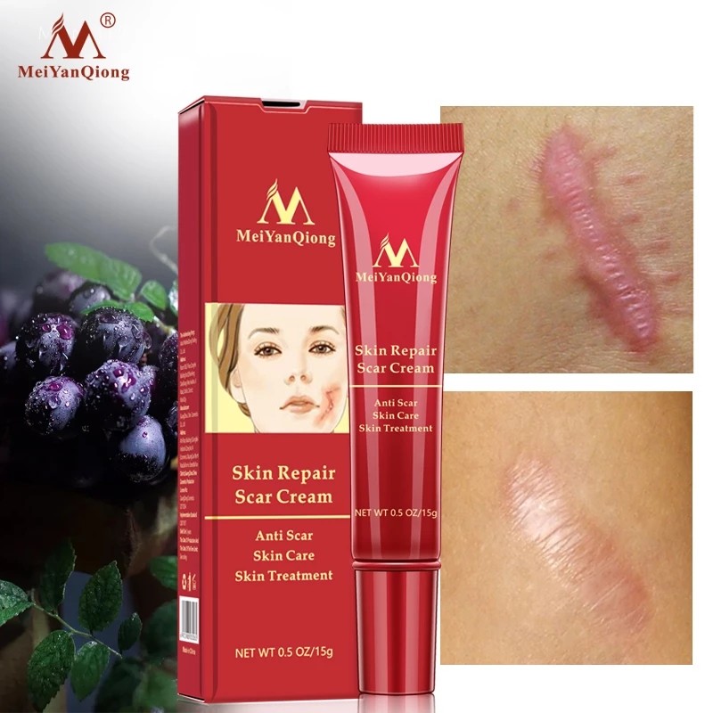 Hot Sale Skin Care Anti Scar  for Old Scars on Legs and Face