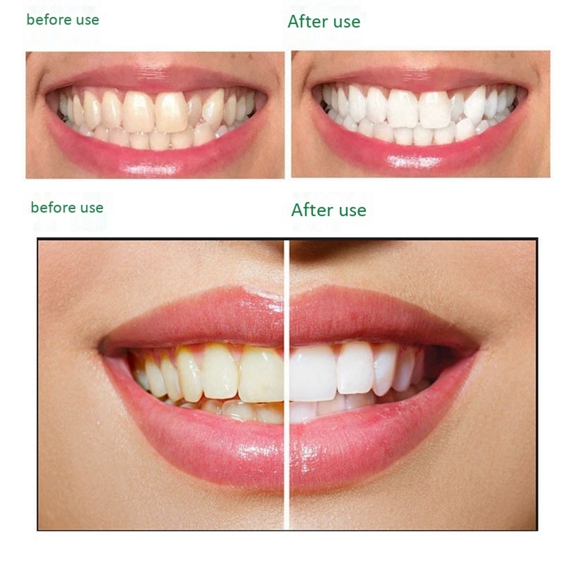 DR.RASHEL Herbal Toothpaste Whitening Remove Stains Aloe Toothpaste120g