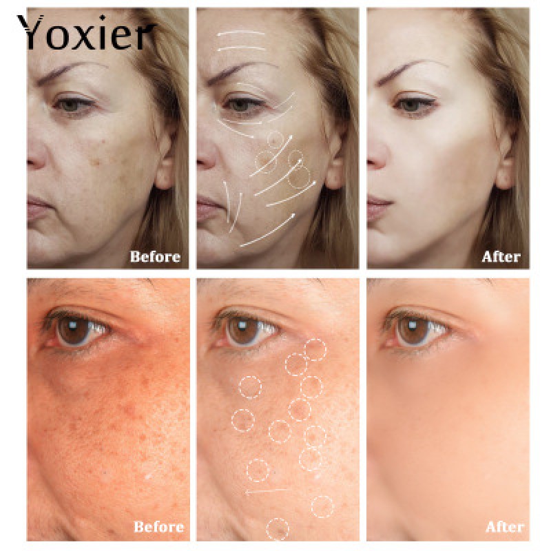 Yoxier Balance Face Cream Skin Care for Whitening and Oil Control Snail-Inspired Water & Oil Balance Lotion