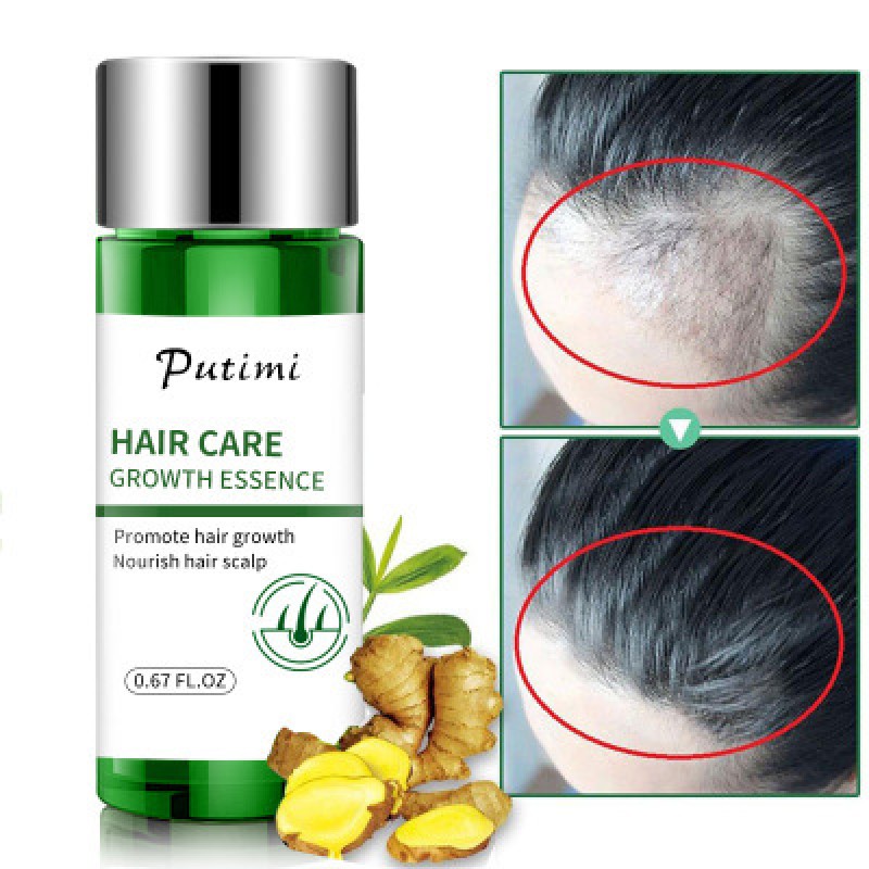 Organic Hair Growth SerumTreatment Preventing Hair Loss Moisturizing Wild Growth Hair Oil