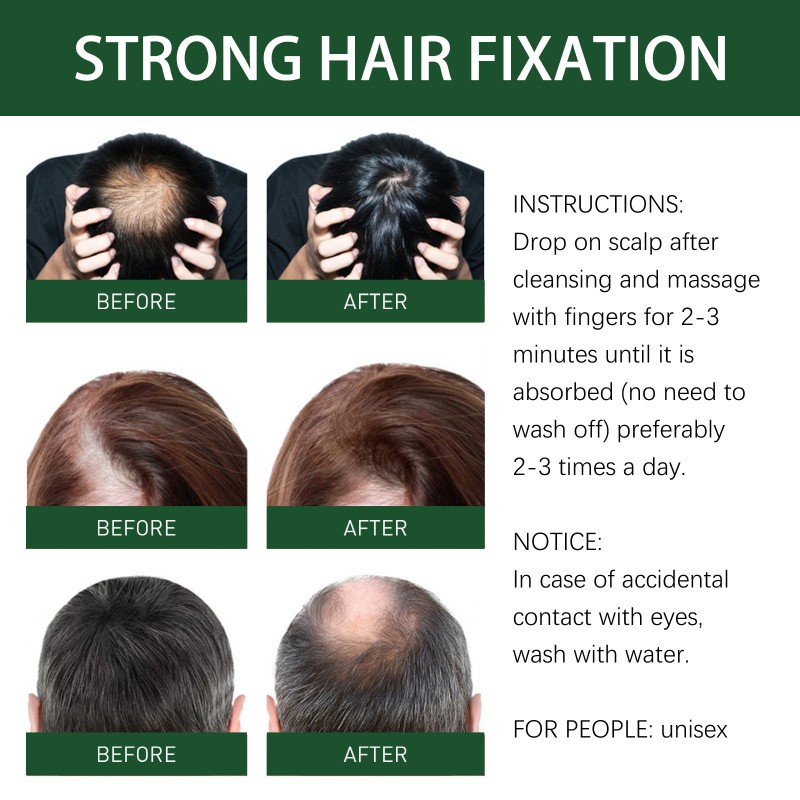 Wholesale Private Label Natural Organic Scalp Black Hair Care Loss Ginger Hair Growth Oil Serum