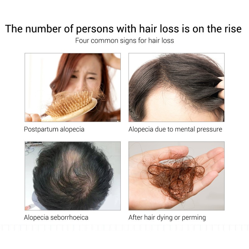 Women's Natural Hair Growth Oil with Argan Oil Customizable Private Label