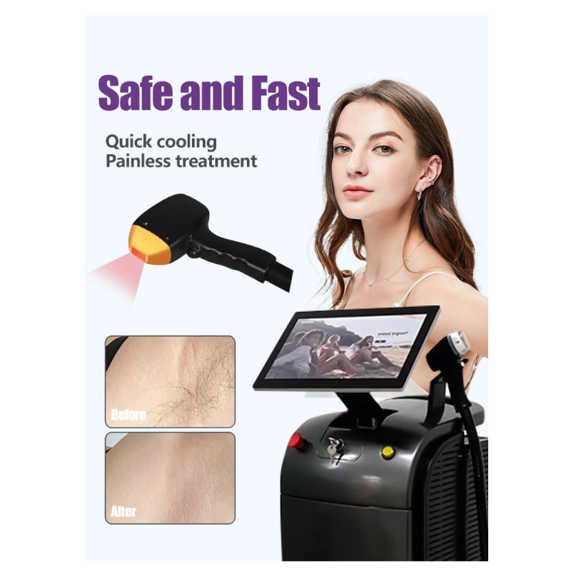 Hot-selling Laser Beauty Equipment 3 Wavelength 808 Diode Laser Hair Removal Machine for Salon Beauty Clinic Home Use