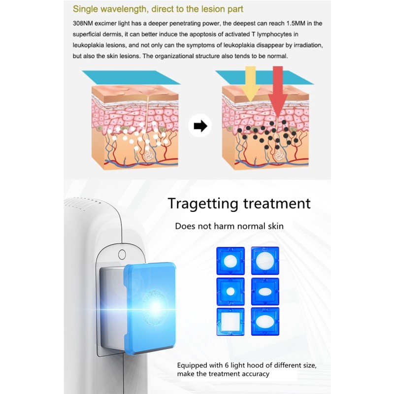 Uv Phototherapy for Vitiligo 308nm Vitiligo Laser Uvb Lamps Electrotherapy Machine Physiotherapy for Hospital Clinic Home Use