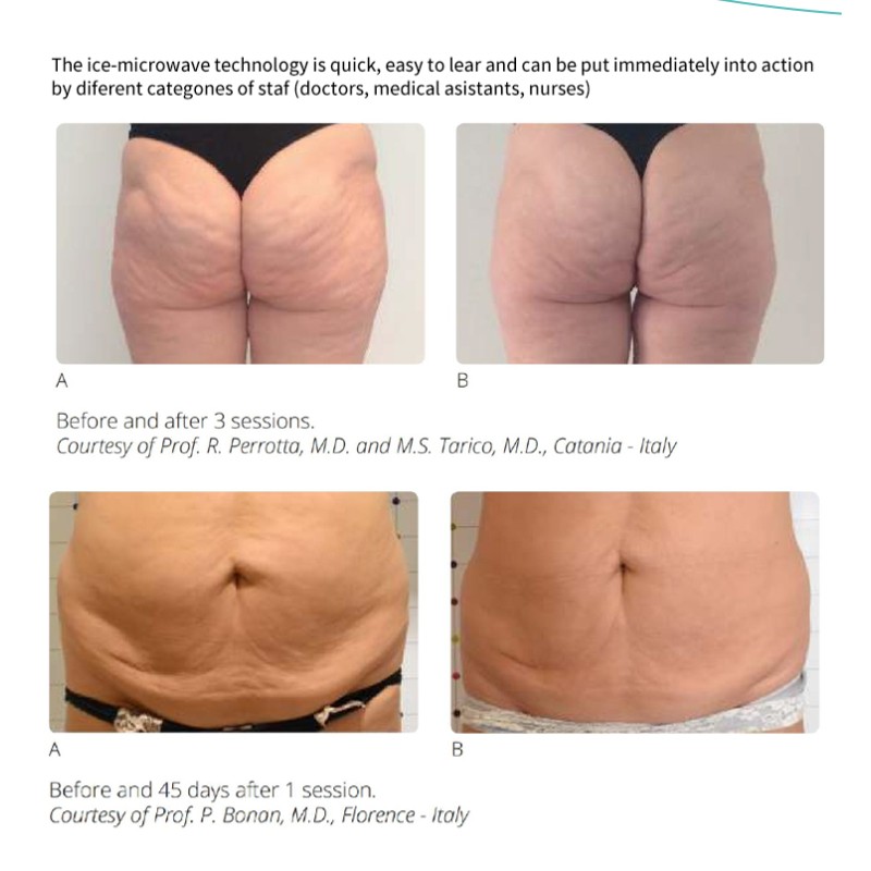 Double Chin Reducer Double Chin Machine 2 Handles 2 In 1 Big Screen For Face Lifting Skin Tightening Body Slimming Machine