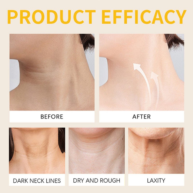 Anti-Wrinkle Hydrating Light Lines Brightening Enhance Bee Venom Wrinkle Cream Bee Venom Moisturizing Whitening Face Cream