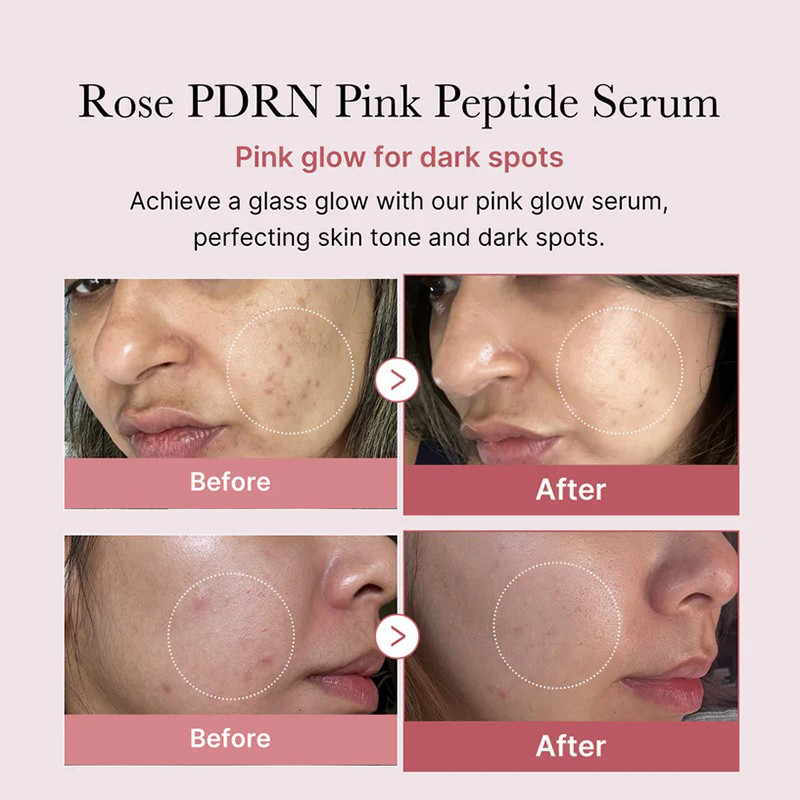 Pink Glow Anti-Aging Skin Booster Serum PDRN Serum Hyaluronic Acid Niacinamide Peptide Salmon DNA for Face Whitening Skin Care