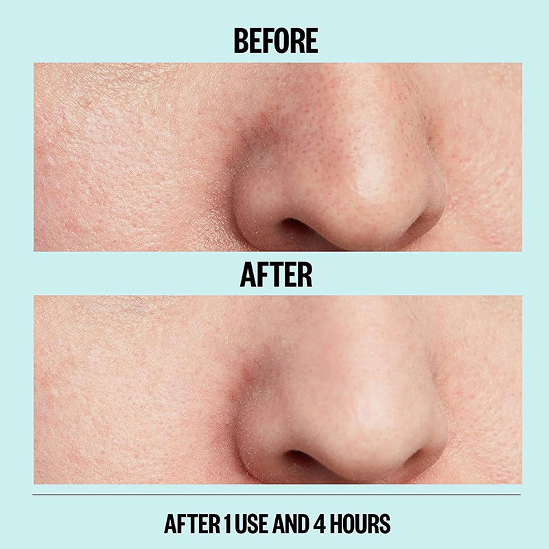 2025 Herbal Hydrocolloid Blackhead Nose Strips Centella Asiatica Tea Tree Oil Deep Cleansing Acne Nose Strips for Men and Women
