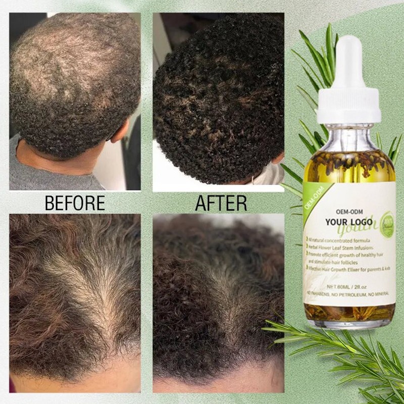 Private Label Organic Fast Jojoba Seed Hair Growth Oil Anti Hair Loss Tonic Natural Rosemary Oil Hair Growth for Men and Women