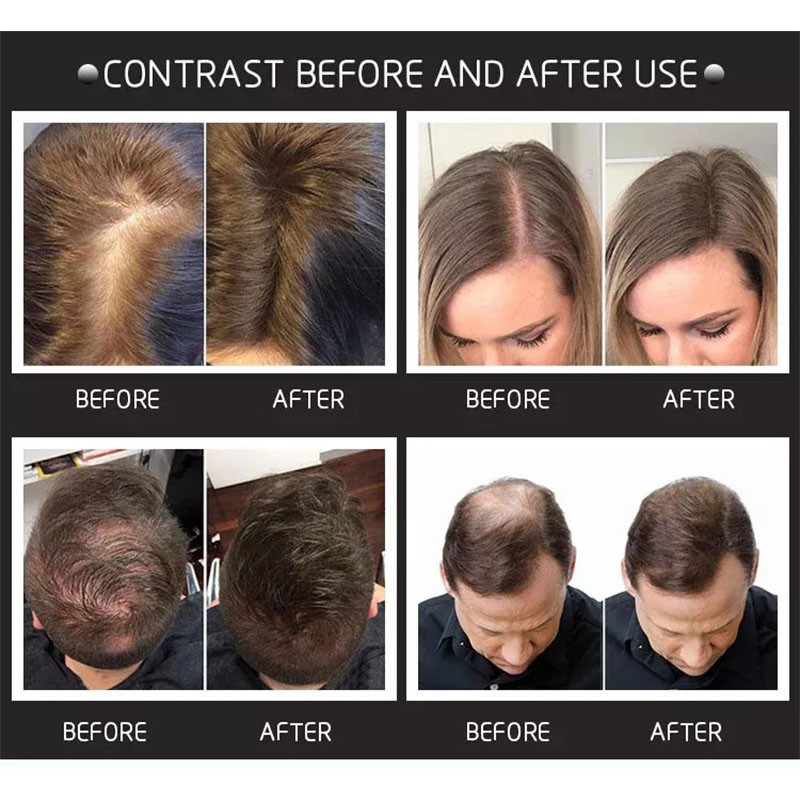 Wholesale OEM Premium Unisex Cotton Hair Thickening Fibers Powder Spray Long Lasting Hair Building Fiber for Thin Hair